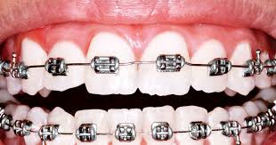 Orthodontics